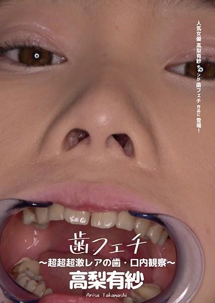 歯フェチ ～超超超激レアの歯・口内観察～ 高梨有紗