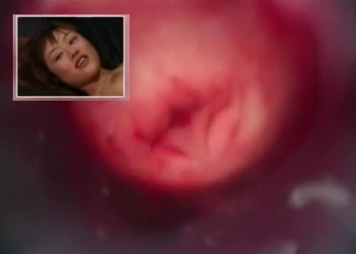 マニア必見・膣内映像！CCDカメラで膣内の子宮口どアップ映像！美女をまんぐり返しでマンコをクスコ開帳しザーメン流し込み！