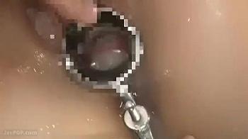 膣内射精されたザーメンをクスコで観察！精子で満タンになったオマンコに追撃チンポで絶頂アクメ！